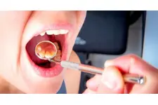 Damakta Şişlik Belirtileri ve Tedavisi